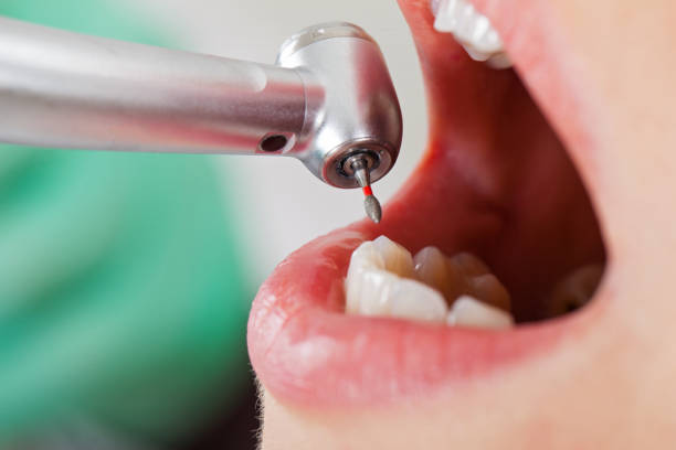 Best Emergency Denture Repair in Danbury, TX